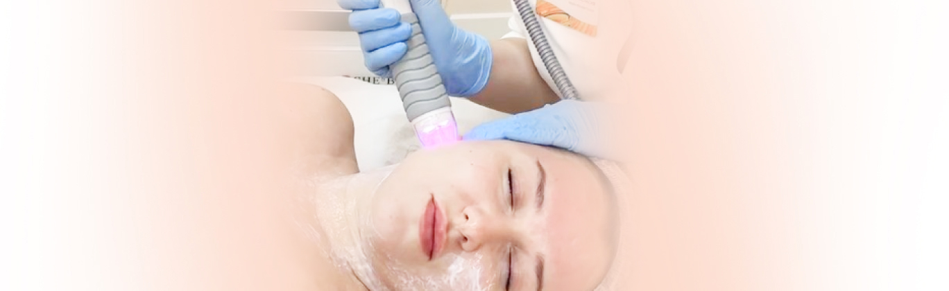 RF-лифтинг