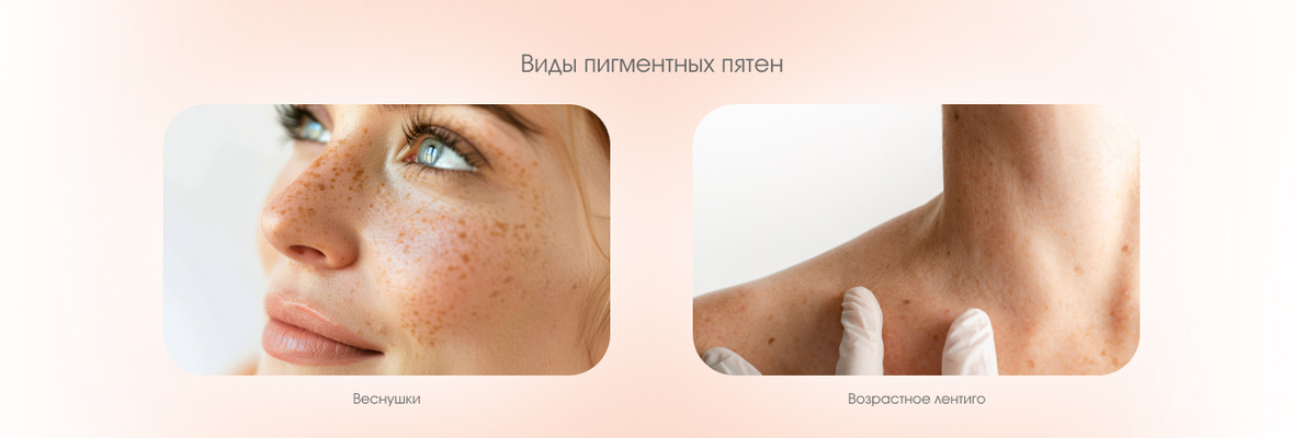 de755edd-2c50-4979-b7ab-619f1aadfbe1.jpg